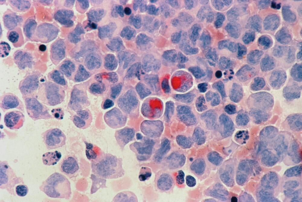 national-cancer-institute