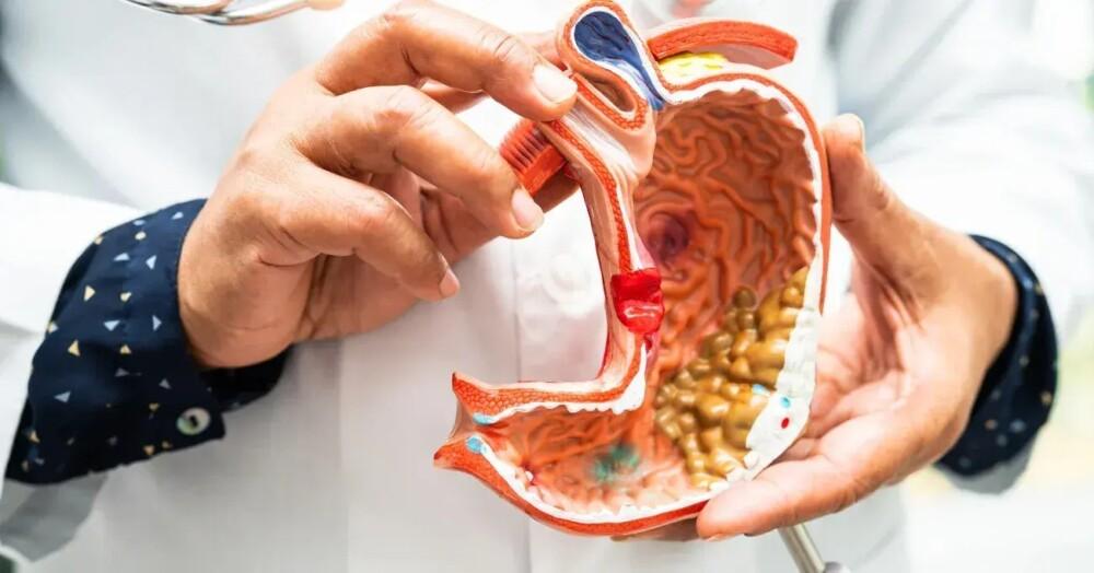 Understanding SIBO: Causes, Symptoms, and Naturopathic Treatments