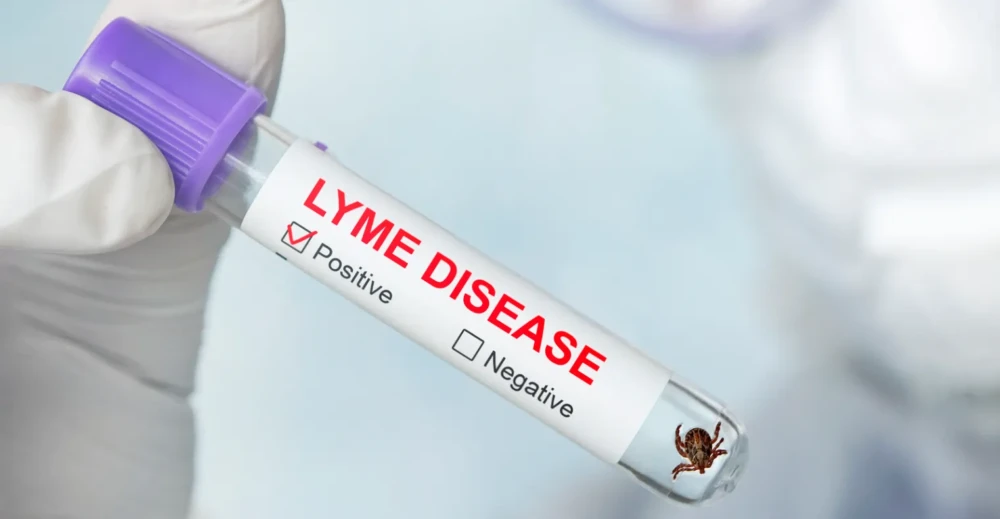 Gloved hand holding a positive Lyme disease test vial with tick illustration.